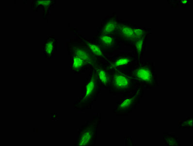 COL4A1 Antibody