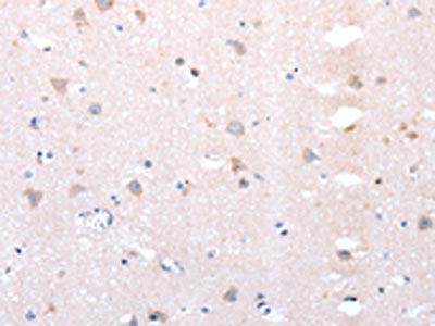 DTX1 Antibody