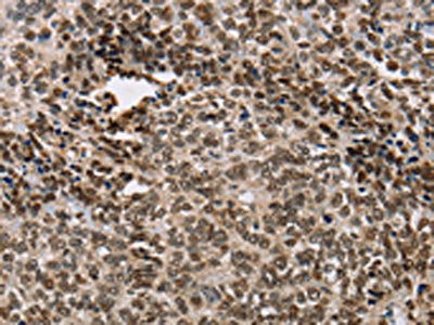ACVR1B Antibody
