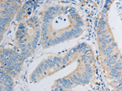 PDX1 Antibody