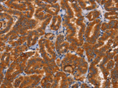 CTSC Antibody