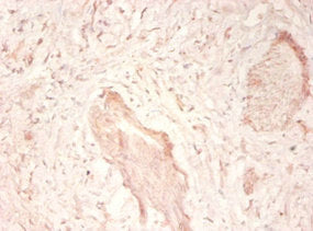 TNC Antibody