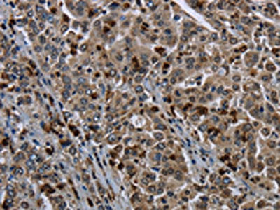 GP1BA Antibody