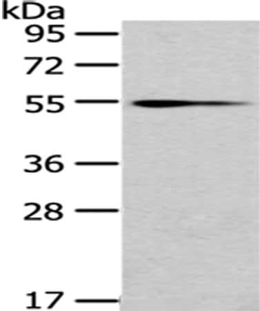 UGT1A4 Antibody