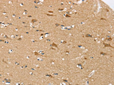 SEZ6L Antibody