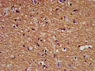 FHIT Antibody