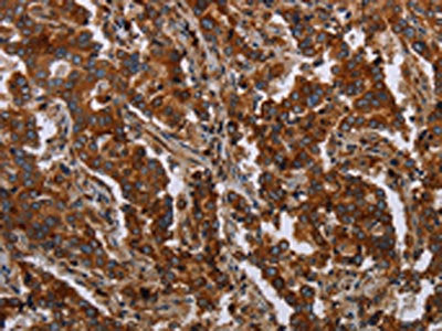 MFSD2A Antibody