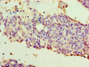 WT1 Antibody