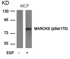 Phospho-MARCKS (Ser170) Antibody