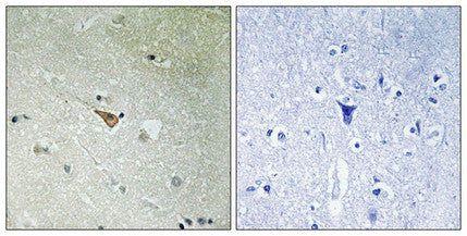 Phospho-ALK (Tyr1096) Antibody