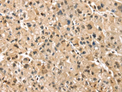 PSMB8 Antibody