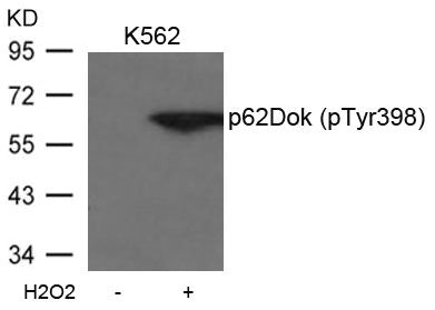 Phospho-DOK1 (Tyr398) Antibody