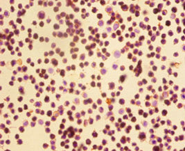 CDK4 Antibody