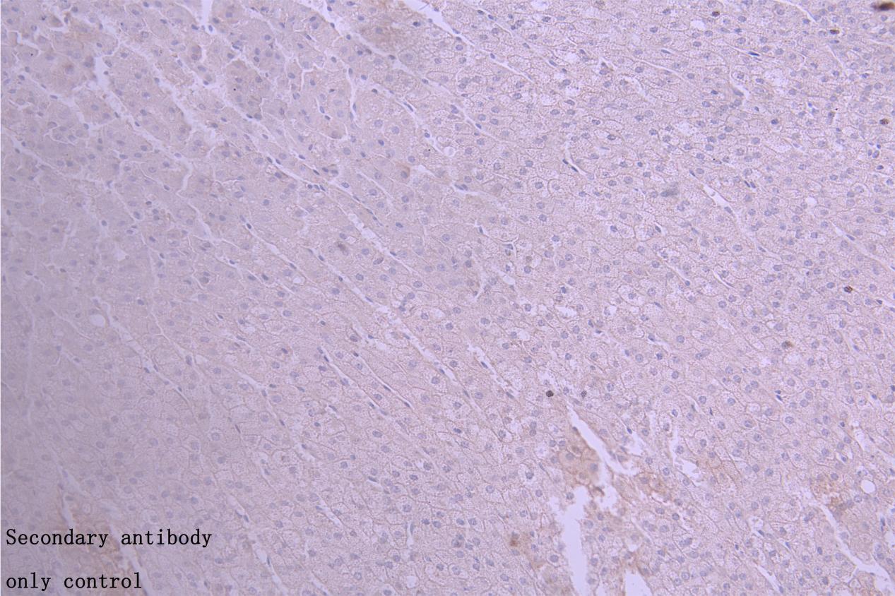 ABCB1 Antibody