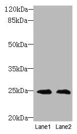 TIMP3 Antibody