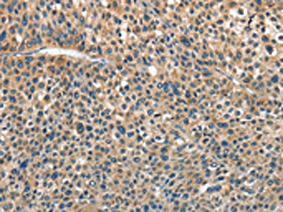 ANGPT1 Antibody