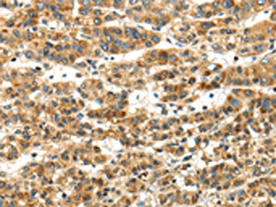 PAPPA Antibody