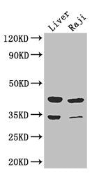 BHMT2 Antibody