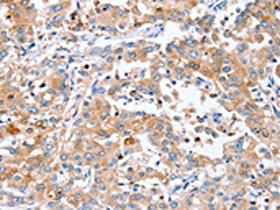 PPOX Antibody