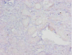 MGMT Antibody