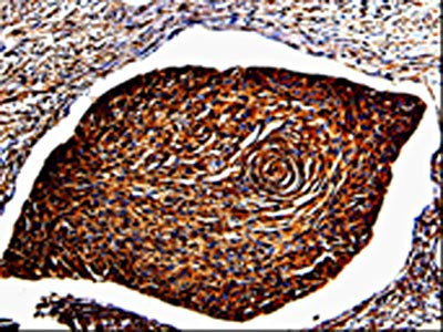 ANXA7 Antibody