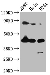 MSTN Antibody