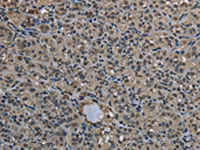 UBB Antibody