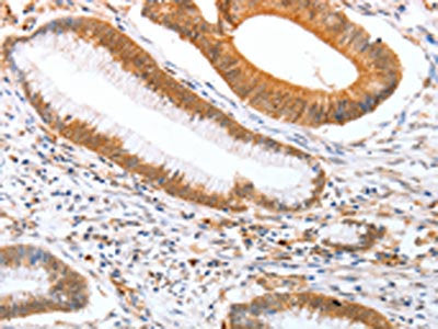 DPPA2 Antibody