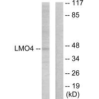 LMO4 Antibody