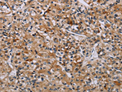 AATK Antibody