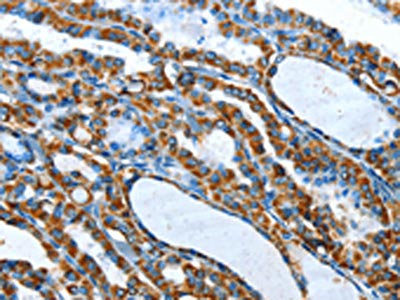 TNNI3 Antibody