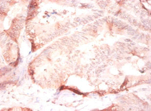 COL4A2 Antibody
