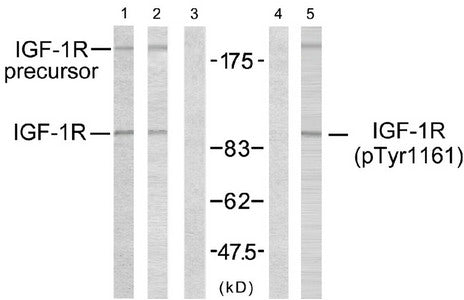 Phospho-IGF1R (Tyr1161) Antibody