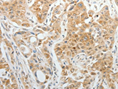 TTF2 Antibody