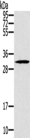 DKK1 Antibody