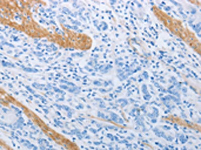 ADRB3 Antibody