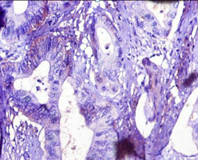 TTR Antibody