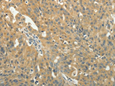 TAGLN2 Antibody