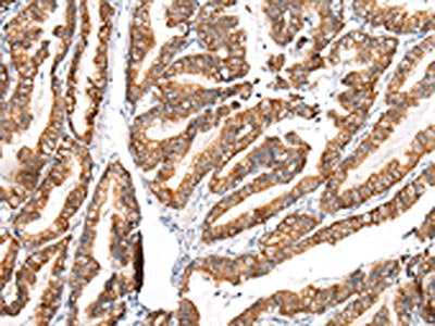 KRT7 Antibody