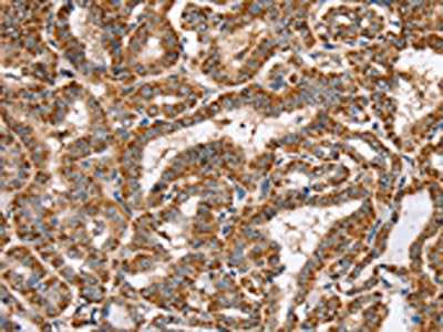 PPOX Antibody