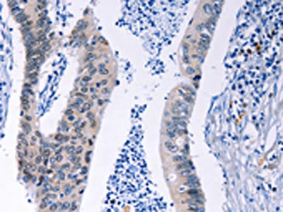 HMGB3 Antibody