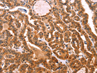 PROS1 Antibody