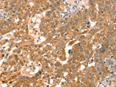 RPS6KA1 Antibody