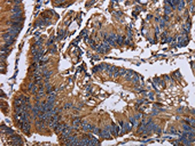 KRT31 Antibody