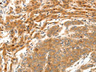 SERPINE1 Antibody