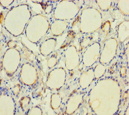 TPO Antibody