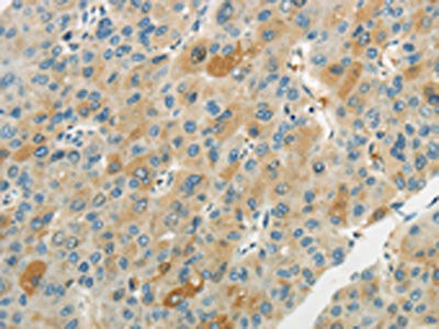 WNT2B Antibody