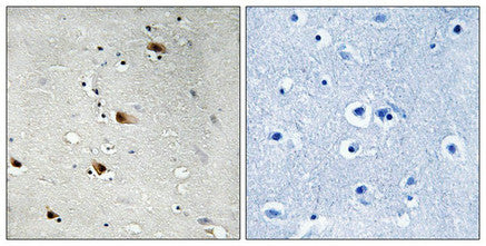 Phospho-TCF3 (Thr355) Antibody
