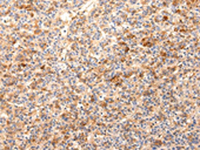 ZNF365 Antibody