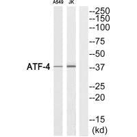 ATF4 (Ab-219) Antibody